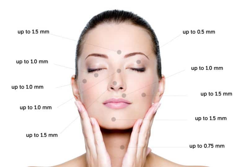Choosing the Correct Derma Roller Needle Size