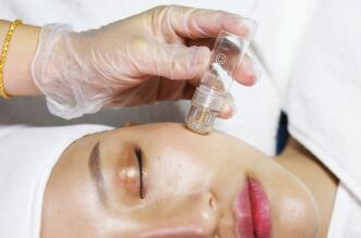 Tips for before and after dermarolling